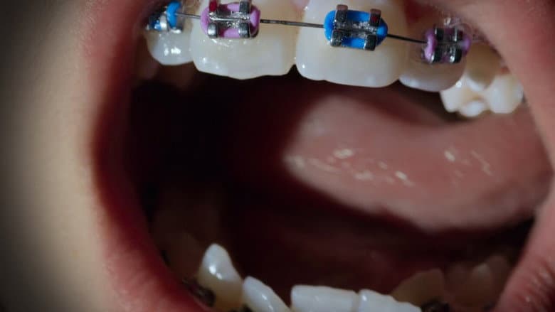 Open Wide still