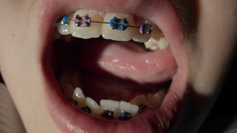 Open Wide still